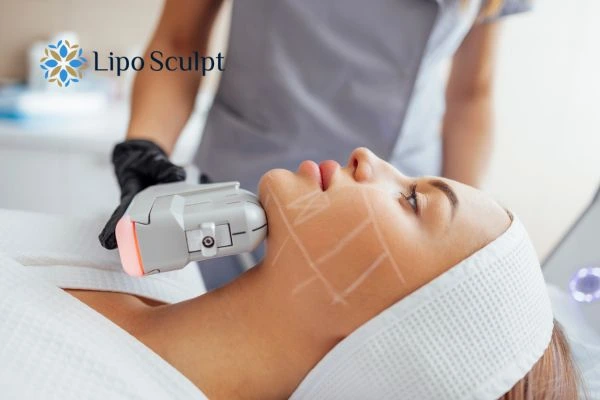 HIFU vs Botulinum Toxin: Understanding the Differences 1 HIFU vs Botox Sudbury What is the best option for you?