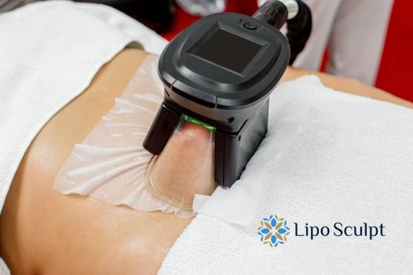 Does Fat Freezing at Home Work? DIY Devices vs Professional Cryolipolysis 1 How is professional cryolipolysis different Sudbury?