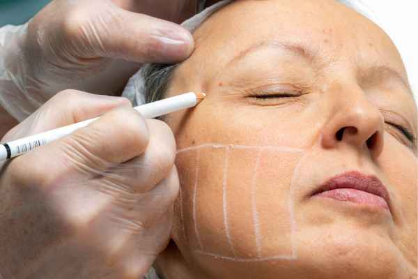 CryoPen: 5 Skin Concerns It May Be Used to Treat 4 What should you ask before having CryoPen treatment Sudbury?